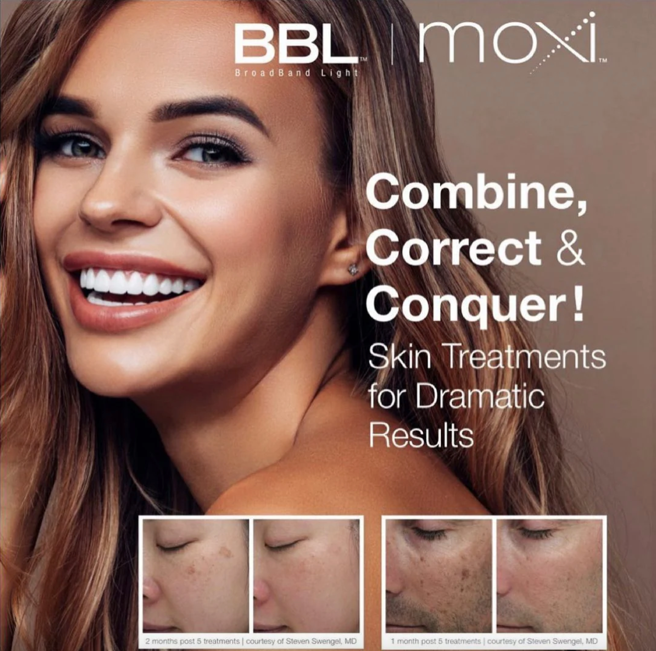 BBL and Moxi Corrective Treatment