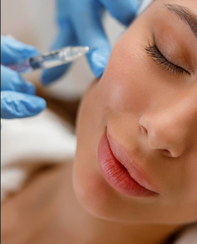 Dermal Fillers