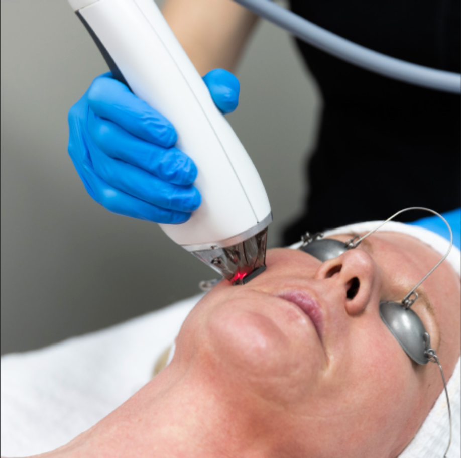 Mspa Signature Laser Facial